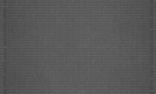 Is Your Insurance Coverage Adequate?